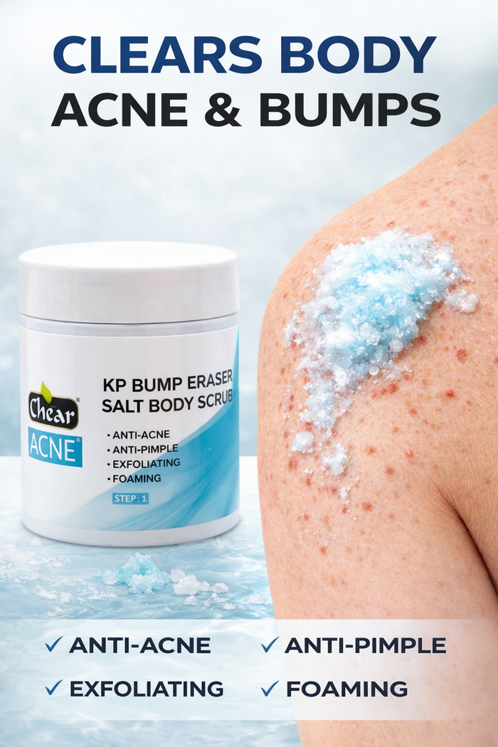 Chear KP Bump Eraser Body Scrub 300g | Keratosis Pilaris & Acne Body Scrub | Smooth Rough Skin, Strawberry Legs & Bacne | Salicylic Acid + Niacinamide