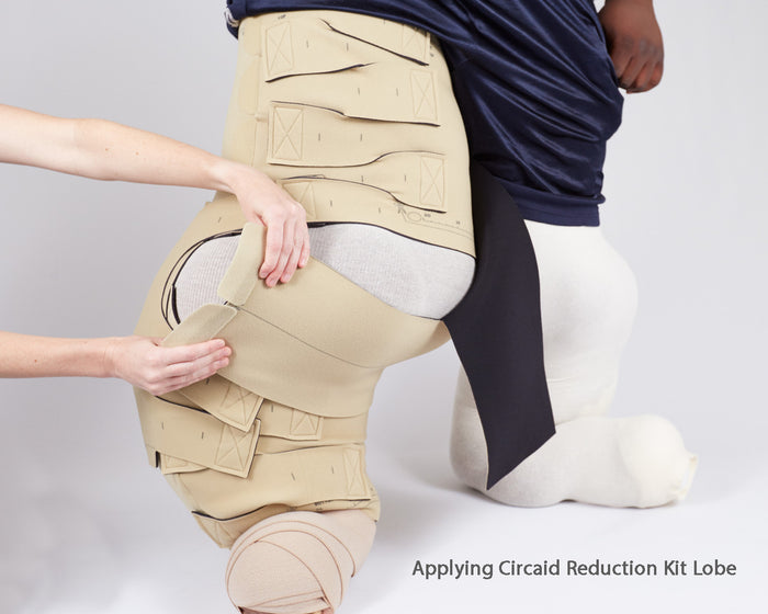 Circaid Reduction Kit Lobe