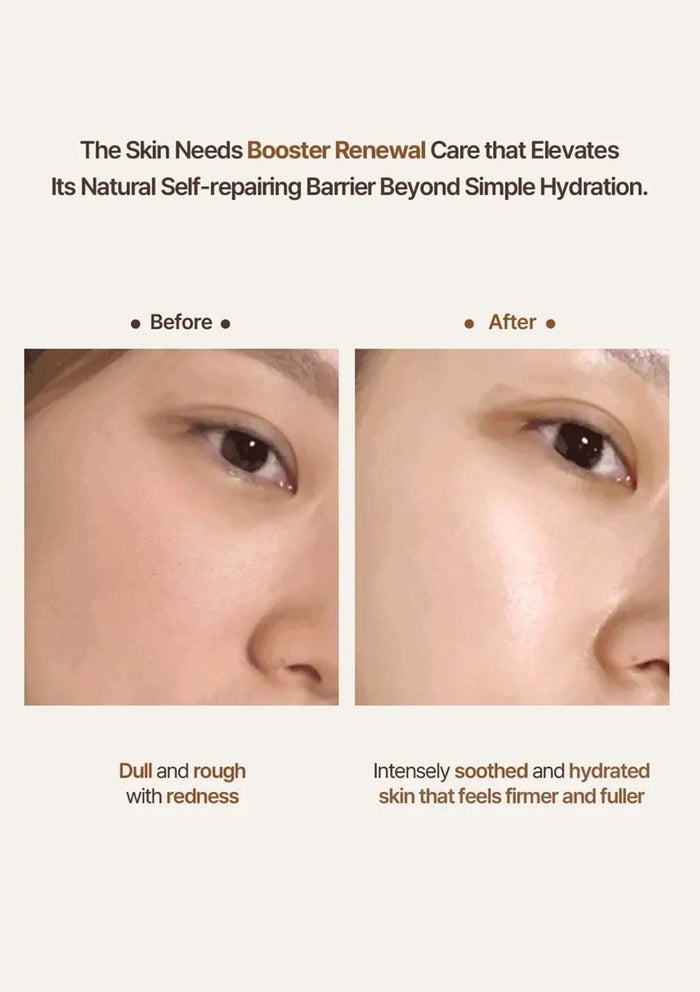 Before and after comparison of skin care treatment with text about booster renewal care.